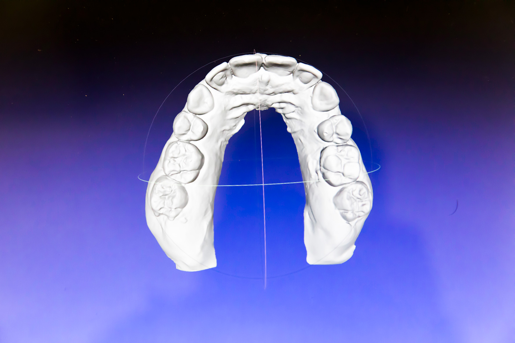 Digital scan for arch alignment | NATE JENSEN