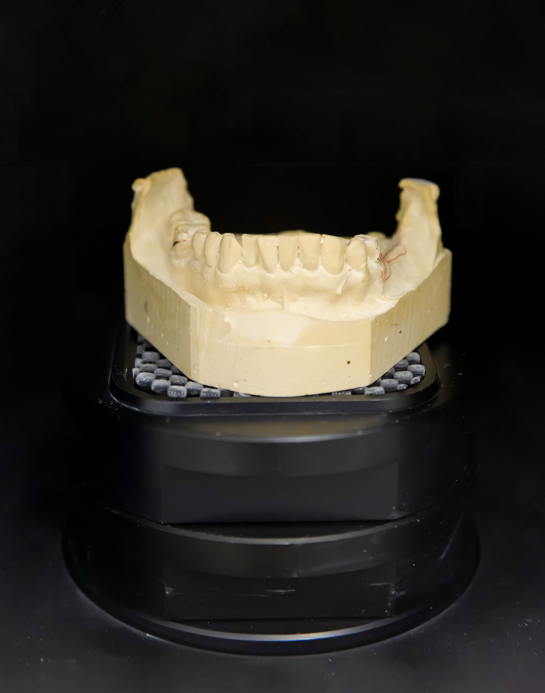 <em>Left:</em> A cast sits inside a desktop scanner for 3-D printing of dentures. <em>Right:</em> Fabricating provisional restorations in the simulation laboratory.  | NATE JENSEN