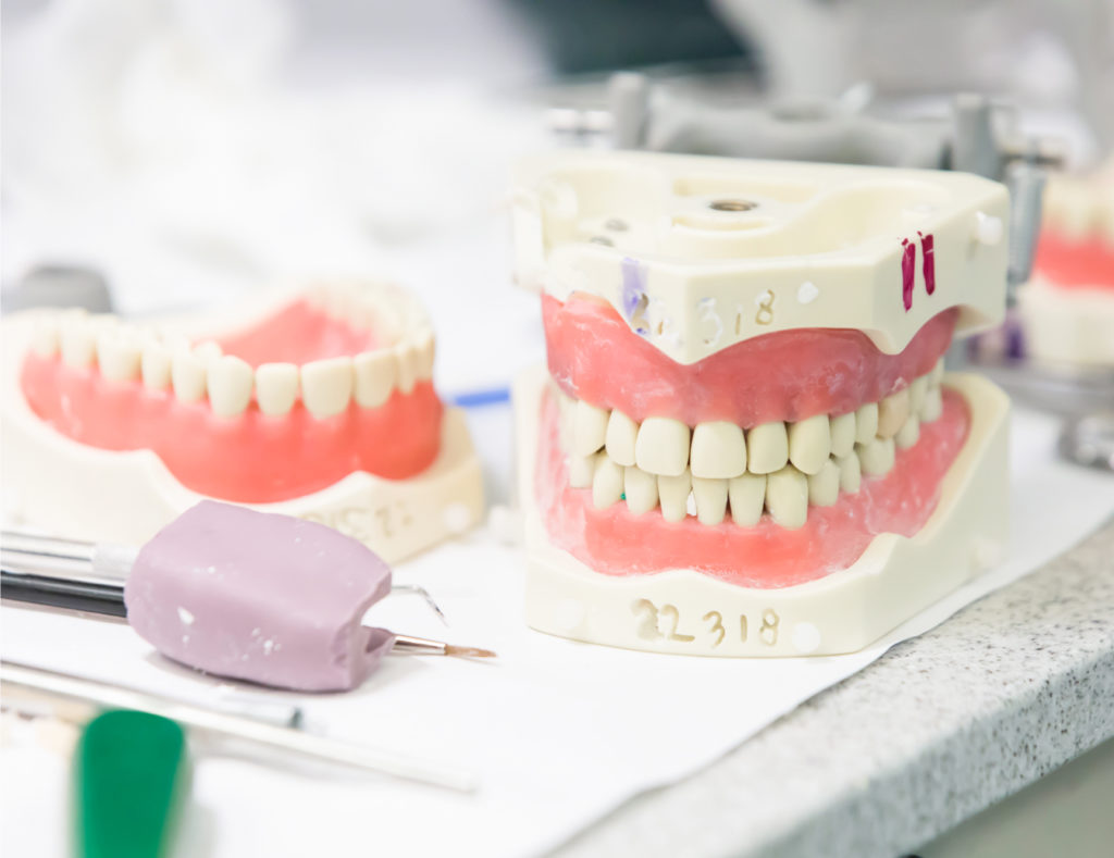 Typodonts and putty for provisional restorations