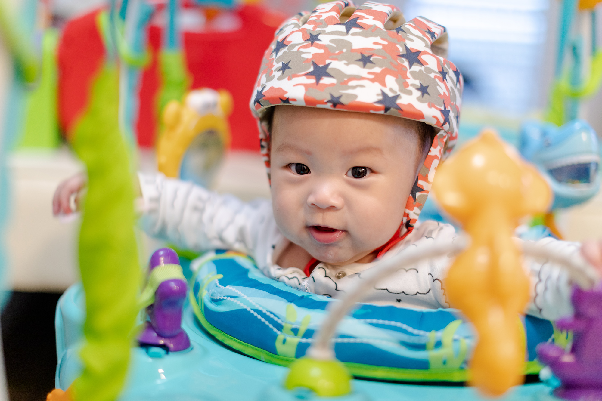 baby wearing orthopedic helmet after craniosynostosis surgery