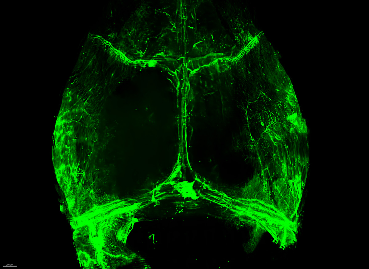 The lymph system within the skull